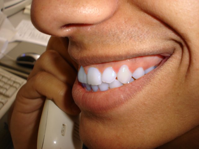 gimp – bílé zuby